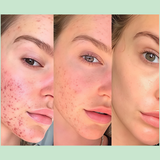 Luméa Radiance Wand (6 Pieces - 60% OFF )