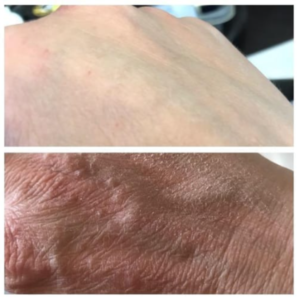 Luméa Radiance Wand-Neon + Argon (6 Pieces - 60% OFF)