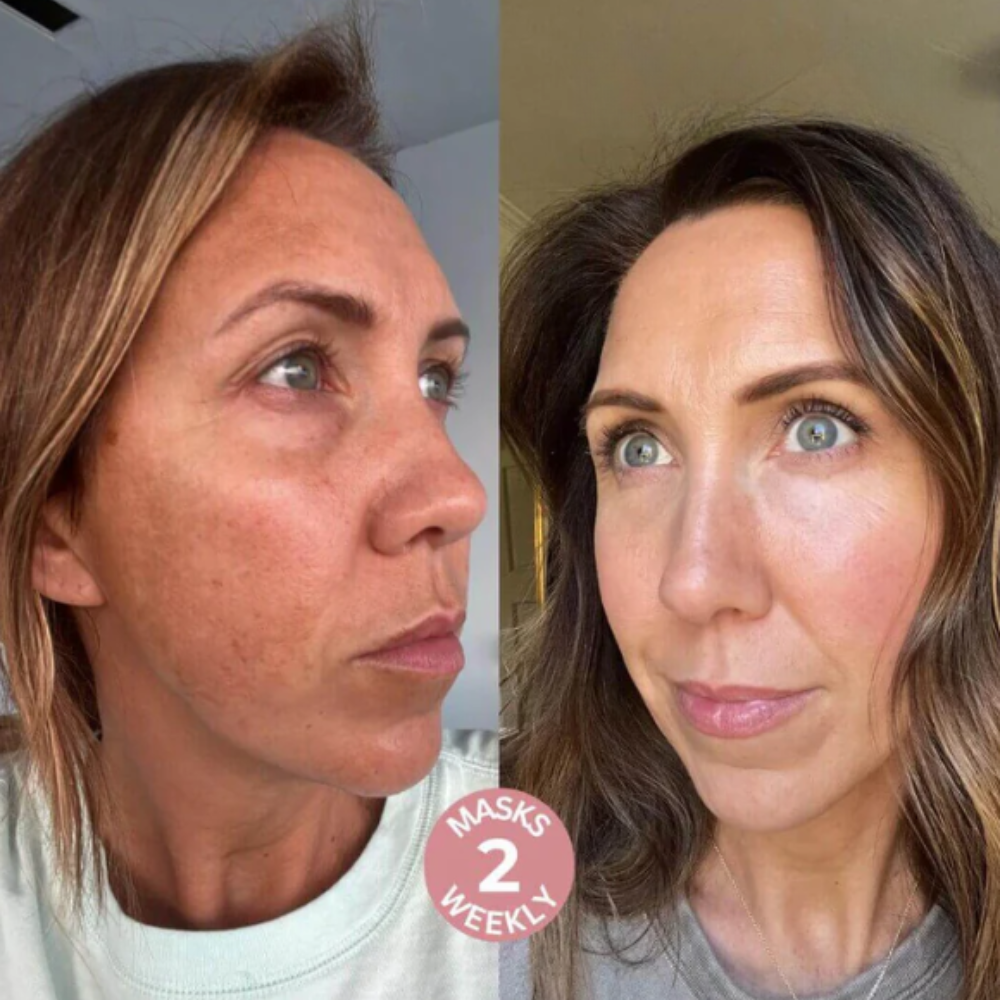 Collagen Infusion Masks