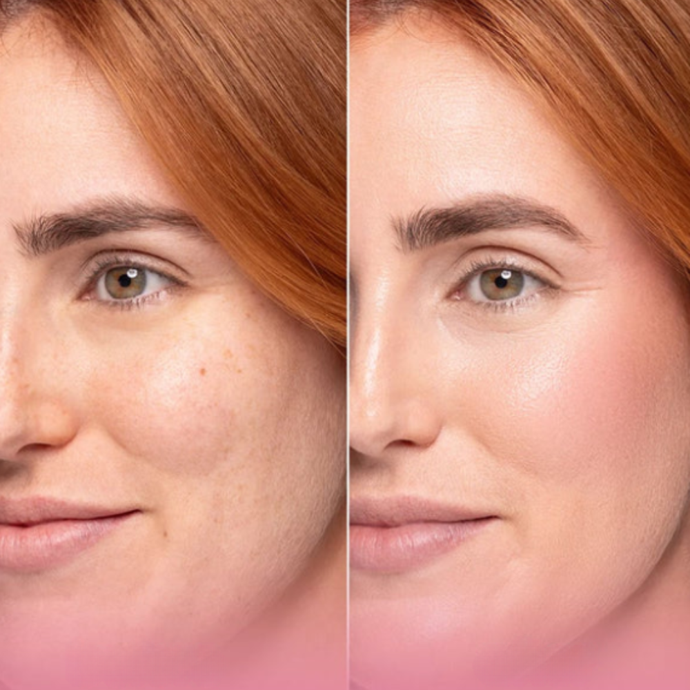 Collagen Infusion Masks