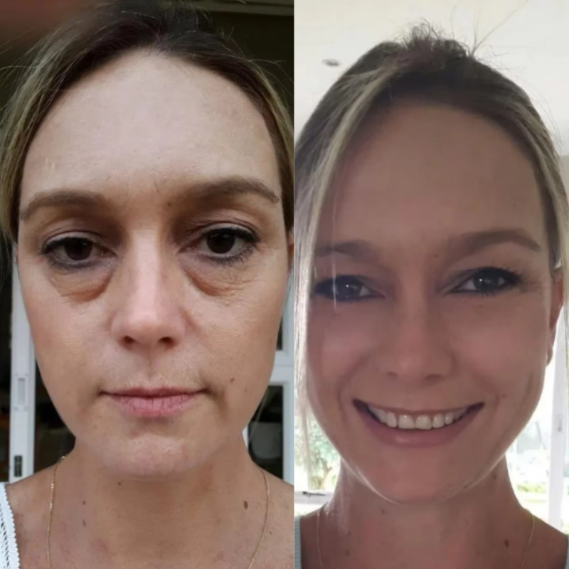 ReviveLux Red - Light Therapy Glasses