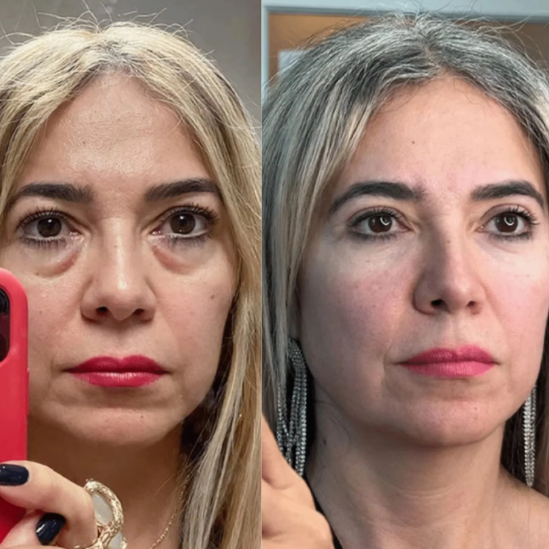 ReviveLux Red - Light Therapy Glasses